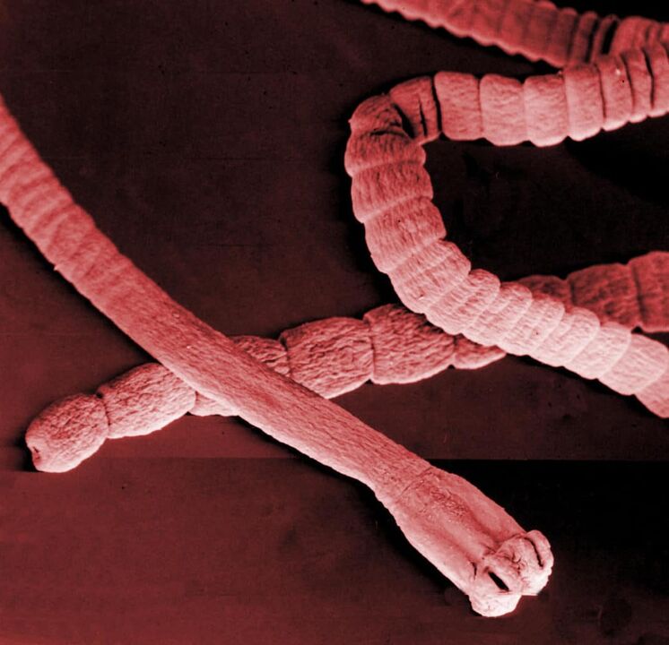 tapeworm